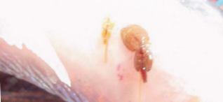 Sea lice